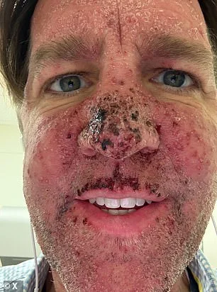 Ben Sasse's Terminal Battle with Pancreatic Cancer: A Harrowing Journey Through Experimental Treatment