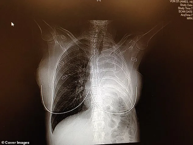 The Faded Blue Bomber Jacket: A Relic That Unraveled a Mother's Health