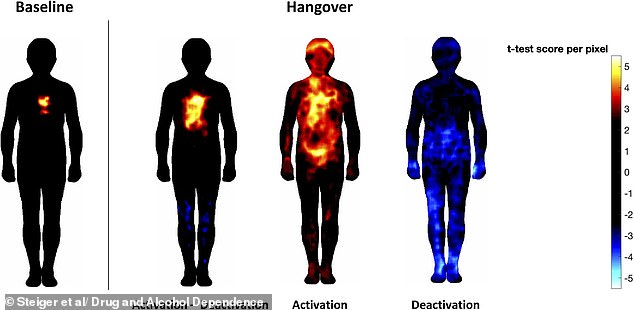 Study Maps Hangover Pain and Weakness Across Human Body