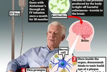 Alzheimer's Drug Donanemab: Promising Treatment or Health Risk?