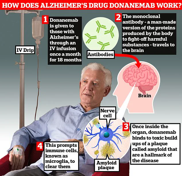 Alzheimer's Drug Donanemab: Promising Treatment or Health Risk?