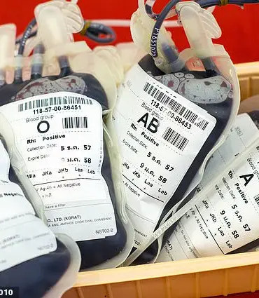 Blood Type Linked to Higher Risk of Stomach Cancer: New Study Reveals