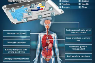 Exclusive Report Reveals Surge in 'Never-Event' Incidents of Incorrect Implants and Prosthetics in NHS