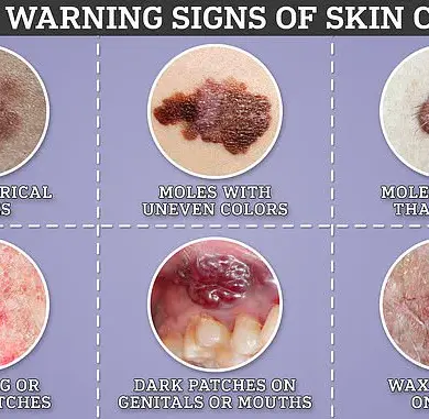 Tattoos Linked to Higher Risk of Skin Cancer in New Study