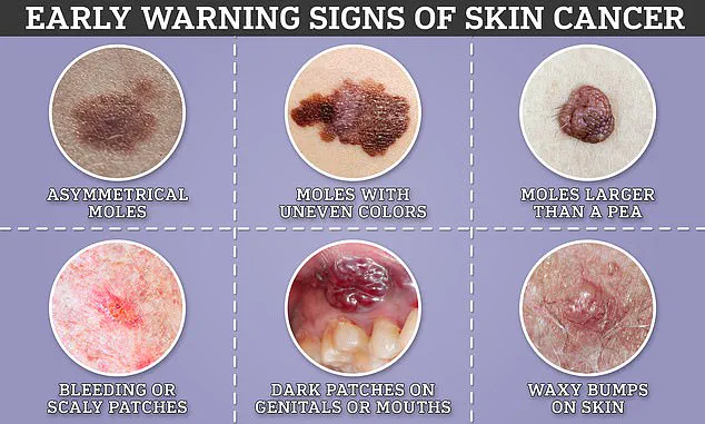 Tattoos Linked to Higher Risk of Skin Cancer in New Study