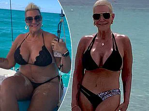British Women Embrace 'Pubic Lift' Trend as Demand Surges 500 Percent