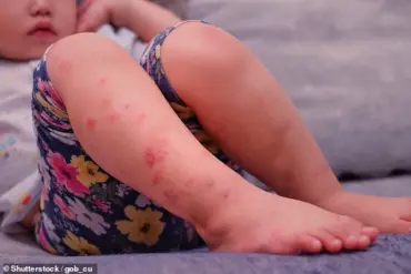 Fifty Michigan Residents Potentially Exposed to Measles as Toddler Spreads Virus Across Multiple Locations