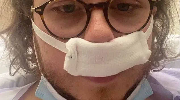 Medics Warn of Over-The-Counter Nasal Spray Addiction and Health Risks