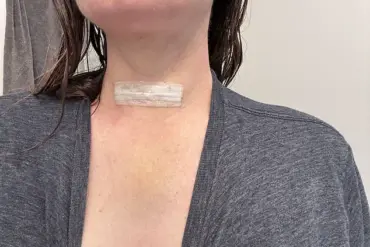Mother Diagnosed with Rheumatoid Arthritis After ChatGPT Alerted Her to Symptoms