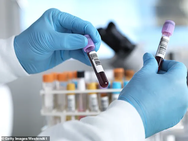 NHS Launches Trial for New Blood Test Using AI to Detect Cancer Earlier and Faster