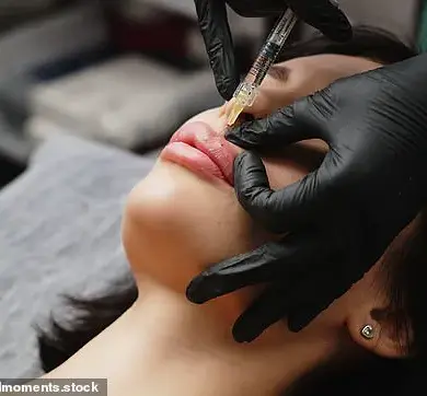 Rush to Reverse: Thousands Flee Botched Cosmetic Filler Treatments
