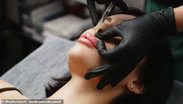 Rush to Reverse: Thousands Flee Botched Cosmetic Filler Treatments