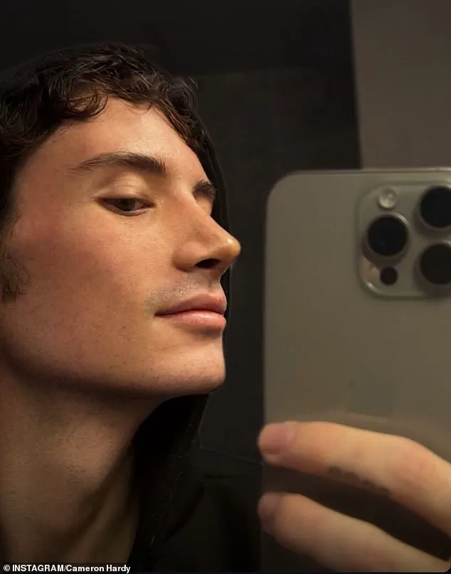 YouTube Sensation Cameron Hardy Returns with Shocking Transformation