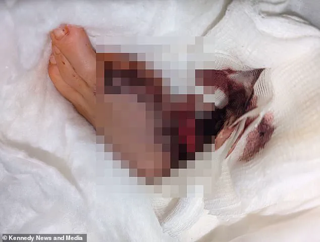From DIY Ritual to Medical Crisis: The Unseen Risks of Self-Administered Pedicures