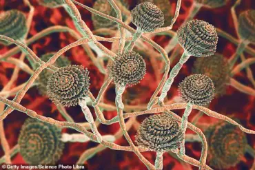 Global Health Crisis: Deadly Fungus C. auris Spreading in Hospitals, Resisting Infection Control Measures
