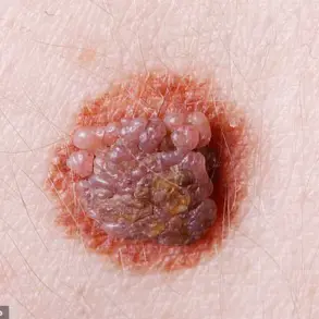 Decoding the Skin’s Signals: Early Signs of Health Issues Revealed by Experts