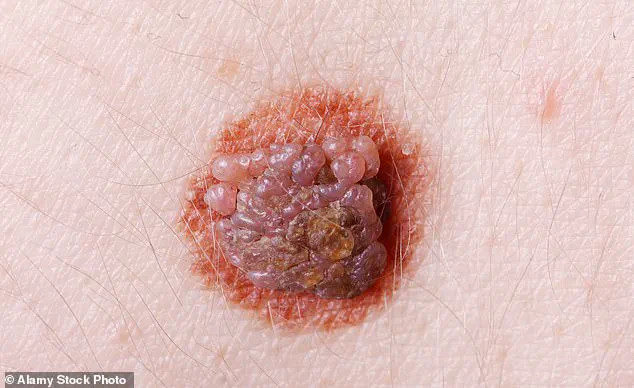 Decoding the Skin’s Signals: Early Signs of Health Issues Revealed by Experts