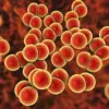 England Faces Syphilis Resurgence as Lambeth Reports 138 Cases Per 100,000, Highest Since 1948