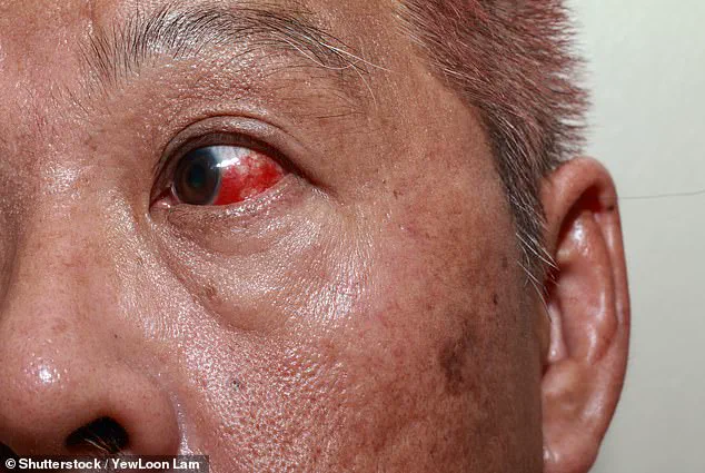Eyes Reveal Urgent Early Warning Signs of Aggressive Cancers