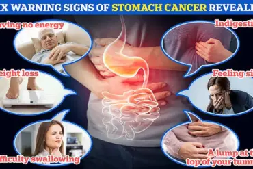 Health Experts Warn on Spicy Food Risks After Influencer's Stomach Cancer Death, Highlighting Irregular Eating Habits