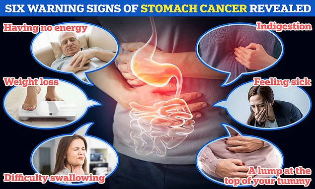 Health Experts Warn on Spicy Food Risks After Influencer's Stomach Cancer Death, Highlighting Irregular Eating Habits