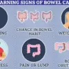 Rising Early-Onset Cancer Linked to Microbiome Changes, Studies Suggest