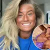 As Concerns Grow Over Sunbed Use, Megan Blain's Story Warns of the Dangers