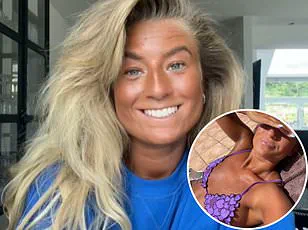 As Concerns Grow Over Sunbed Use, Megan Blain's Story Warns of the Dangers