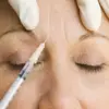From Deadly Neurotoxin to Cosmetic Treatment: The Story of Botox