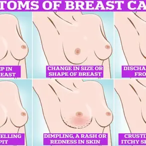 Groundbreaking Study Links Excess Body Weight to Higher Breast Cancer Risk in Postmenopausal Women, Says Peer-Reviewed Research