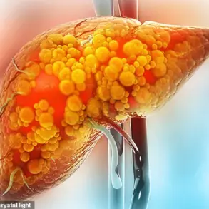 Late-Breaking: Niki Nash's NAFLD Advocacy Challenges Stereotypes, Urges Timely Awareness