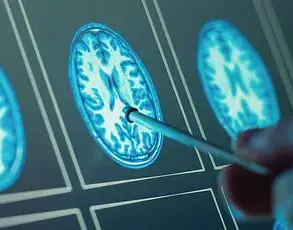 Study Reveals Link Between Organ Health and Increased Risk of Cognitive Decline and Chronic Diseases