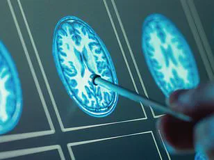 Study Reveals Link Between Organ Health and Increased Risk of Cognitive Decline and Chronic Diseases