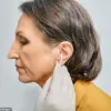 The Hidden Culprit Behind Social Isolation: How Earwax Affects Millions, According to Experts — 'It Wasn’t Until I Felt the Silence That I Realized How Much I’d Lost,' Says Audrey Houghton