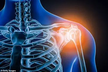 The Ripple Effect of Untreated Shoulder Injuries: How Personal Struggles Impact Communities