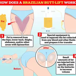 Tragic Death of Police Officer Following Brazilian Butt Lift Surgery