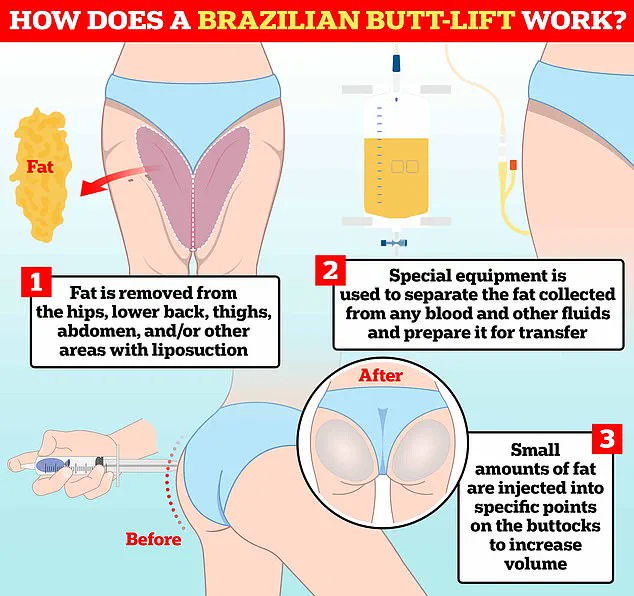 Tragic Death of Police Officer Following Brazilian Butt Lift Surgery