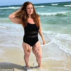 Weight-Loss Influencer Lexi Reed's Journey Through Calciphylaxis and Health Advocacy