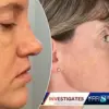 Botched Breast Surgery and Legal Battle: Severe Complications Raise Questions About Cosmetic Clinic's Standards