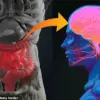 Constipation in 70% of Parkinson's Patients Identified as Early Indicator of Disease, Study Reveals