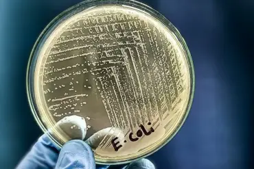 E. coli Outbreak Linked to Raw Milk in Florida: Health Officials Urge Caution Amid Confidential Farm Investigation