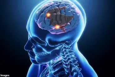 Ketamine Addiction Crisis: Rising Rates Across All Walks of Life, Experts Warn