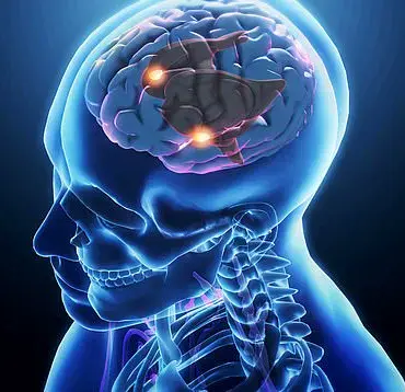 Ketamine Addiction Crisis: Rising Rates Across All Walks of Life, Experts Warn