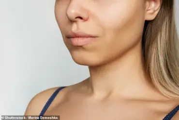 Surge in 'Barbie Botox' Procedures Sparks Debate Over Cosmetic Trend