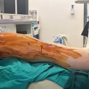 Surge in UK Men Paying Abroad for Painful Height-Boosting Surgery as Demand for 'Leg Lengthening' Procedures Soars
