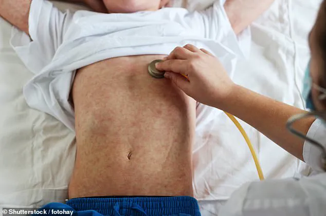 Urgent Alert: Measles Case Confirmed at Washington Dulles Airport Raises Outbreak Fears Amid Traveler Exposure Risk