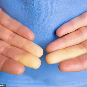 Regulatory Advances May Bring Relief for Raynaud's Patients